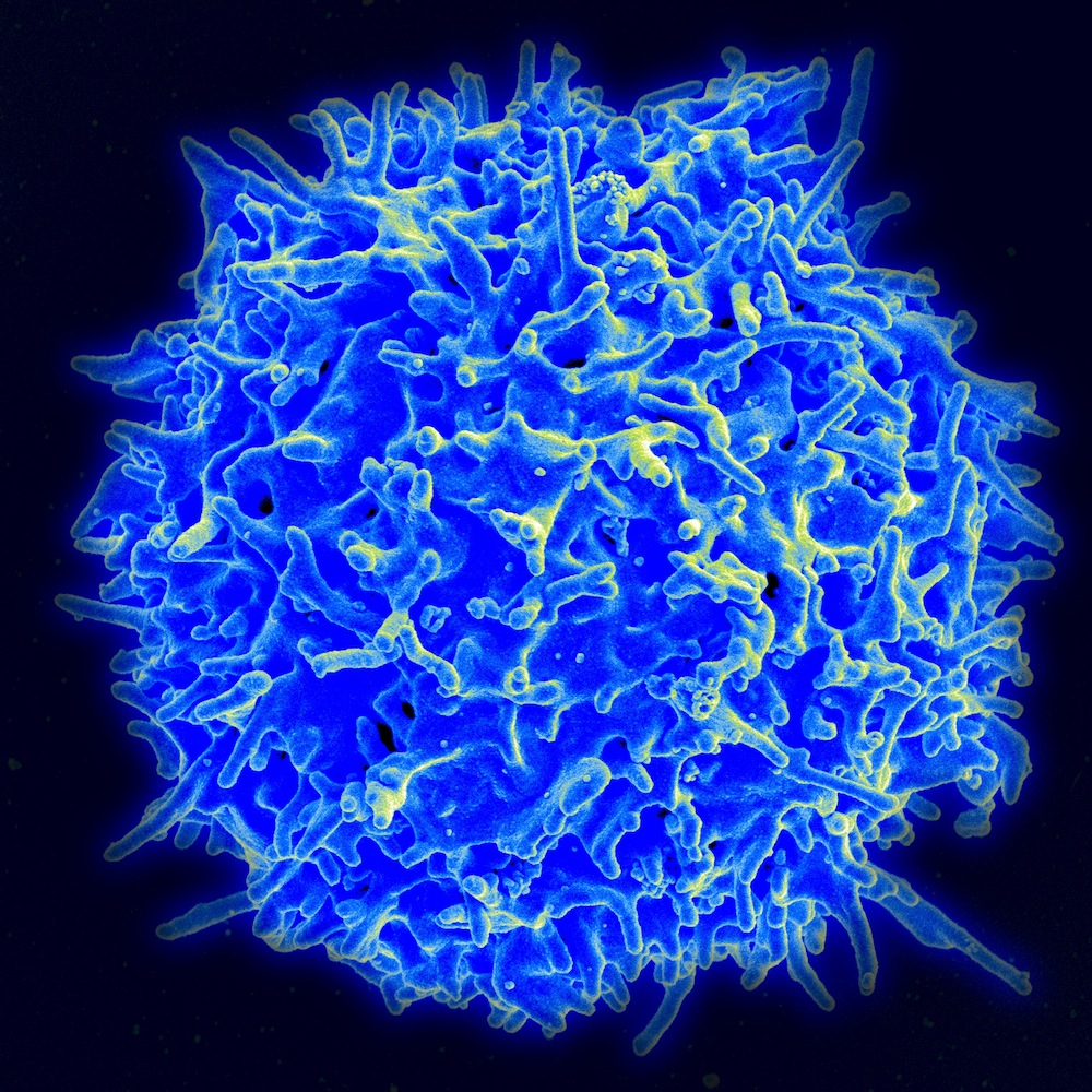 Scanning electron micrograph of a human T cell / Credit: Wikipedia