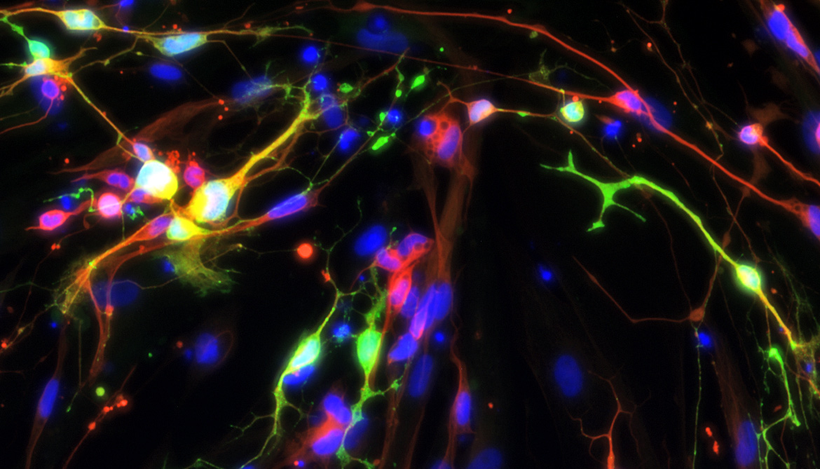 Creating serotonin neurons in the lab can be a start to understanding and treating certain kinds of mental illness. Creating serotonin neurons in the lab can be a start to understanding and treating certain kinds of mental illness.