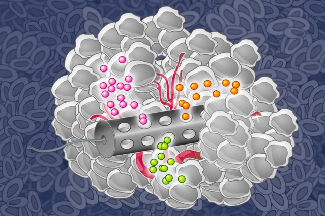 MIT chemical engineers have designed an implantable device that can deliver many drugs at once, allowing researchers to determine which drugs are the most effective against a patient's tumor. I MIT chemical engineers have designed an implantable device that can deliver many drugs at once, allowing researchers to determine which drugs are the most effective against a patient's tumor. I