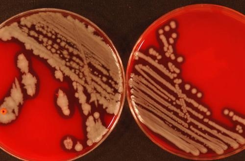 Typical growth pattern of Bacillus cereus colonies in petri dishes. Typical growth pattern of Bacillus cereus colonies in petri dishes.
