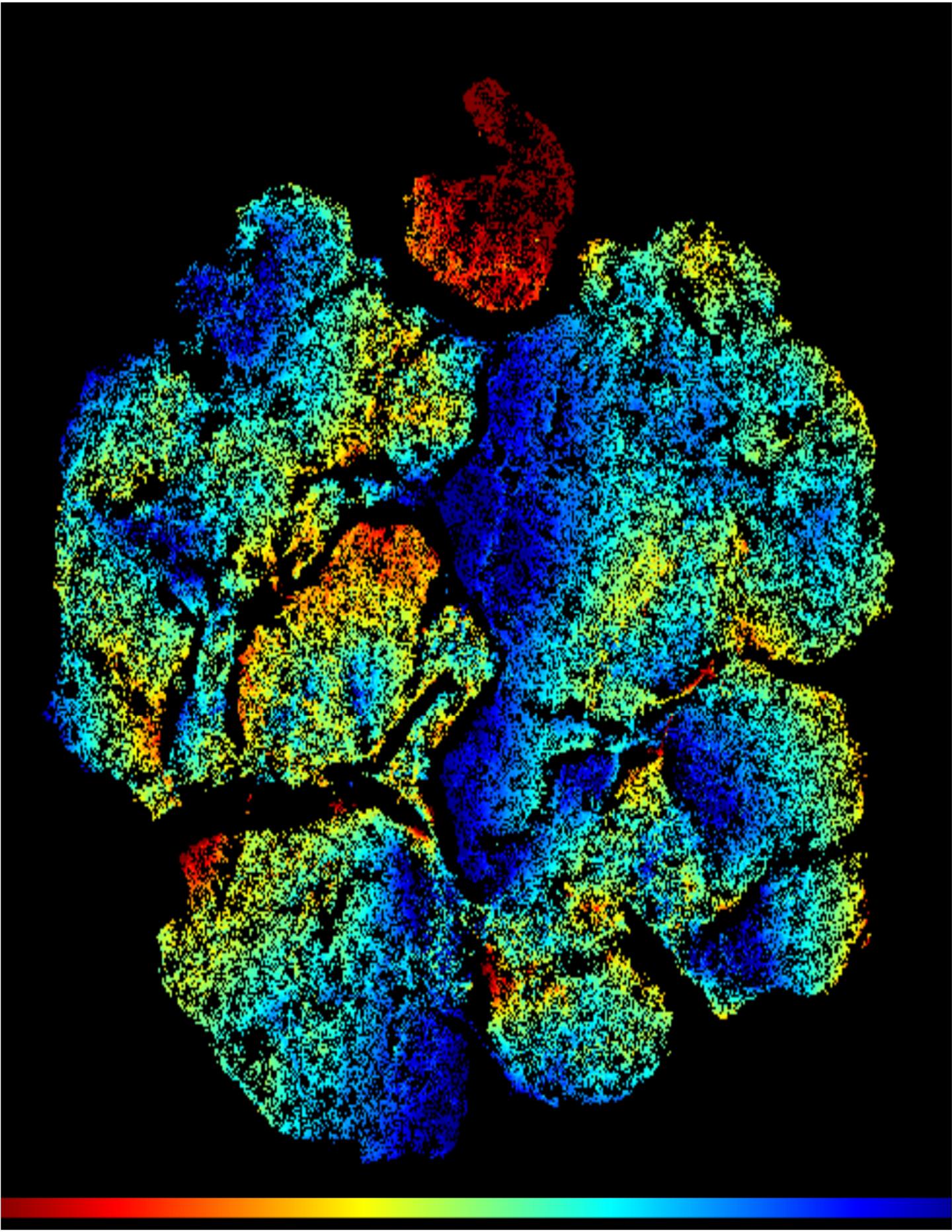 A plot of immature T cells in the thymus: T cell progenitors in red.