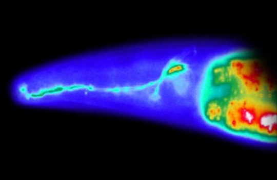 An image of a sensory neuron in a roundworm