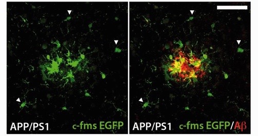 Activated microglia surrounding an amyloid plaque. For full explanation, see figure 3F in Olmos-Alonso, 2016 Brain.