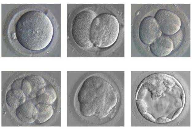 Embryonic development from single cell (top left) to blastocyst (bottom right).