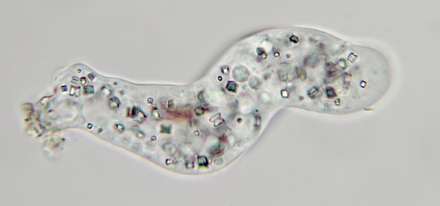 Protists like this one prey on bacteria.