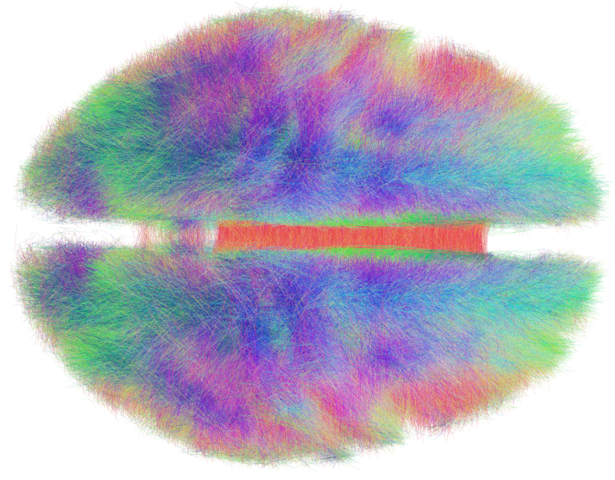The human connectome