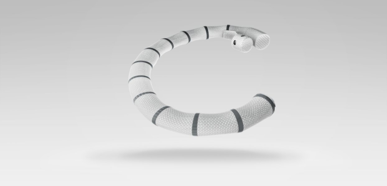 New Catheter Technology Mends Leaky Tricuspid Valve Cardiology