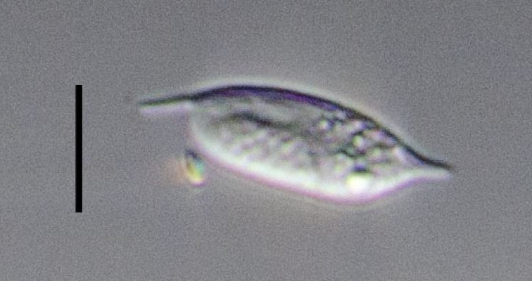 An image of a diplonemid taken at sea; it was isolated for genomic sequencing. / Credit: Patrick Keeling