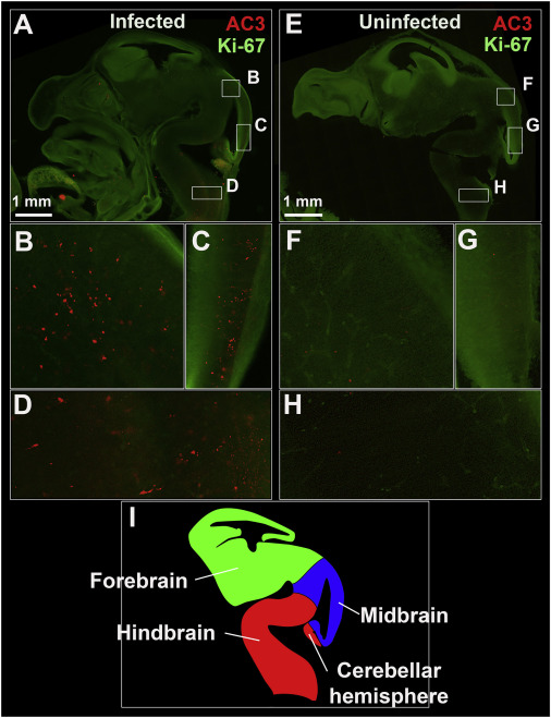 ZIKV Infection Is Associated with Evidence of Apoptosis in the Fetal Brain - (A, E) Sagittal images of representative infected (A) and uninfected (E) fetal heads showing high proliferation. (B-H) Lettered box regions (B-D and F-H) are magnified in corresponding panels below. Higher levels of apoptosis (red dots) can be seen in the midbrain (B-C) and hindbrain (D) of the infected Ifnar1+/? fetus. Alternatively, low levels of physiological apoptosis are seen in the absence of infection (F-H). (I) Diagram depicting the developing E13.5 fetal brain in sagittal view.