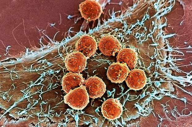 Lasker Foundation gives awards for cancer treatment, DNA damage control and frontline responses to crises. Lasker Foundation gives awards for cancer treatment, DNA damage control and frontline responses to crises.