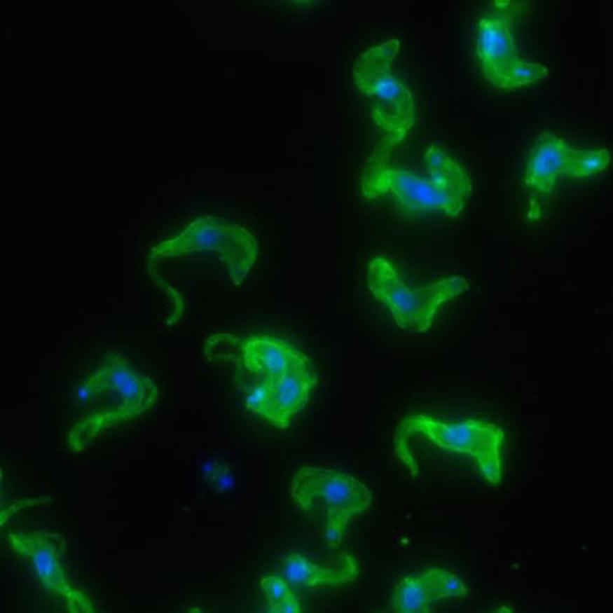 Microscopy image of Trypanosoma brucei, the African sleeping sickness parasite Microscopy image of Trypanosoma brucei, the African sleeping sickness parasite
