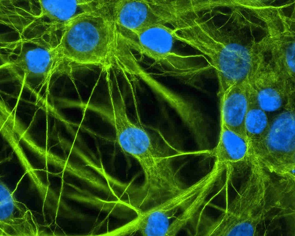 Brain astrocyte cells Brain astrocyte cells