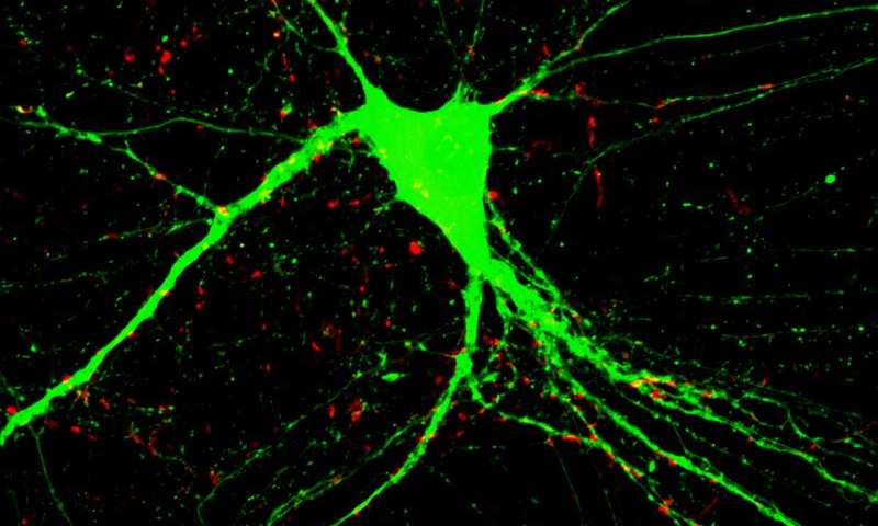 Abnormal behavior of two genes causes schizophrenia. Abnormal behavior of two genes causes schizophrenia.